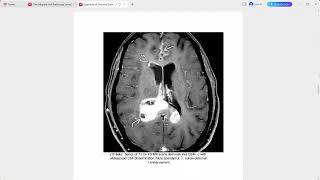 OSBORNE BRAIN IMAGING [upl. by Asseneg108]