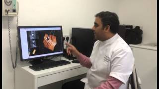 CBCT Scan Full Mouth CT Scan [upl. by Notgnimer]