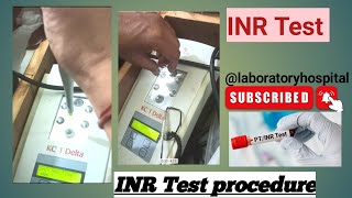 INR Test procedureINR Test Kaise Karte hai INR TEST PT INR Testlabtechinicianslab [upl. by Plusch10]