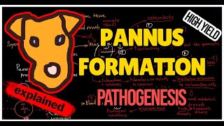 Rheumatology Mechanism of Pannus formation in Rheumatoid Arthritis [upl. by Madden]