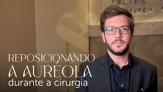 Como posicionamos a auréola na mamoplastia redutora [upl. by Morganstein]