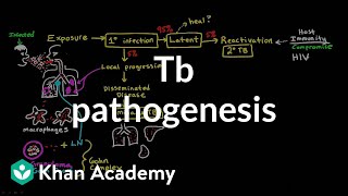 TB pathogenesis  Infectious diseases  NCLEXRN  Khan Academy [upl. by Talanian359]