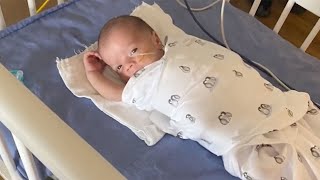 Akron baby battling rare condition [upl. by Akenet]