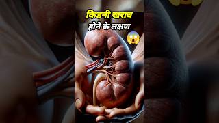 kidney failure symptoms shorts [upl. by Lymn]