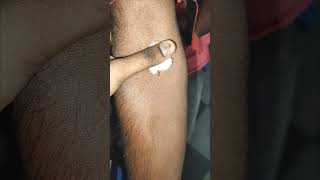 How to give iv injection IV Injection  Intravenous injection shorts [upl. by Ydwor]