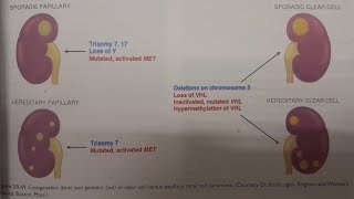 Renal Cell Carcinoma  SPECIAL PATHOLOGY [upl. by Nossila]