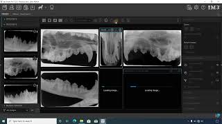 How to Create and Save Layouts for Dental XRays in the iM3 Software [upl. by Laenej383]