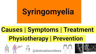 What is Syringomyelia  Pathophysiology  Symptoms  Physiotherapy Treatment [upl. by Ethban558]