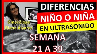 ¿cómo se ve si es NIÑO o NIÑA por ULTRASONIDO SEMANA 21 A 39 por GINECOLOGA DIANA ALVAREZ [upl. by Neetsirk862]