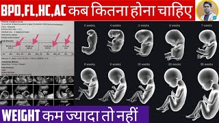 PREGNANCY ULTRASOUND REPORT IN HINDIBPDHCACFLIN PREGNANCY REPORTULTRASOUND REPORT IN HINDI [upl. by Plume113]