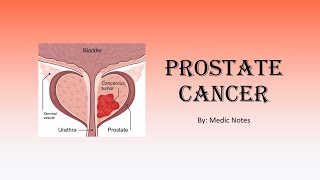 Prostate cancer  symptoms investigations Gleason scoring treatment [upl. by Leifeste645]