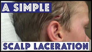 A Sunday Scalp Laceration [upl. by Atnoed]