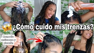 RUTINA DE CUIDADO DE TRENZAS CON RIZOS✨REMEDIO CASERO ELIMINA CASPA Y PICAZÓN EN 5 MINUTOS😱Rachell [upl. by Hofstetter]