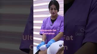 Fat Cavitation [upl. by Bourn268]