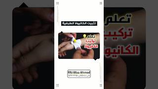 4 طرق لتثبت الكانيولا الطرفية [upl. by Marlena1]