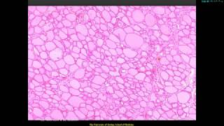 Histology of the thyroid gland [upl. by Zelma]