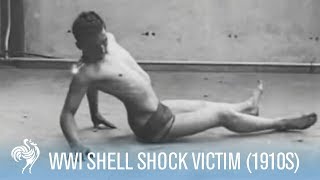 World War 1 Shell Shock Victim Recovery 1910s  War Archives [upl. by Dlarrej]