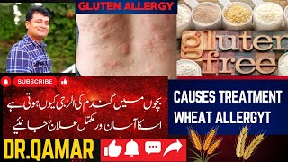 Wheat Allergy Symptoms amp Treatment  Gluten Allergy Symptoms amp Treatment  Dr Qamar [upl. by Ursulina362]