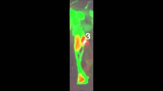 Neuregulin 1 Type IIErbB Signaling Promotes Cell Divisions Generating Neurons from Neural [upl. by Aelaza309]