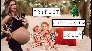 TRIPLET POSTPARTUM BELLY  CARAS POST PREGNANCY LIFE  CHATWIN SIBLING PAJAMA PARTY [upl. by Kola]