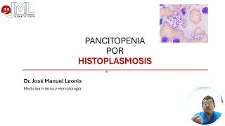 PANCITOPENIA  HISTOPLASMOSIS [upl. by Albrecht248]