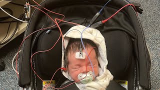 Find out why your newborn failed hospital hearing test it may be the test at fault oae vs abr test [upl. by Eivla]