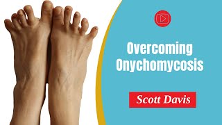 PDF Overcoming Onychomycosis [upl. by Noram840]