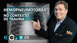 NÍVEL HIDROAÉREO NO ESPAÇO PLEURAL  VOCÊ PRECISA PENSAR EM HEMOPNEUMOTÓRAX NO CONTEXTO DE TRAUMA [upl. by Zoie791]