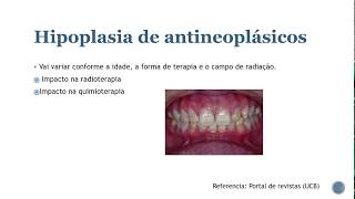 Anomalias dentárias 01 Resumos de odonto [upl. by Trip]