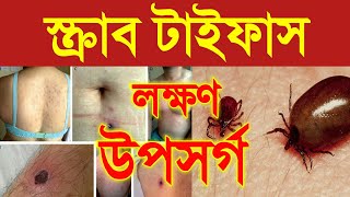 scrub typhus  scrub typhus symptoms  what is scrub typhus disease  symptoms of scrub typhus [upl. by Nospmas]