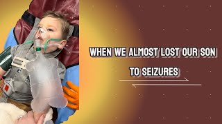 Epileptic seizures baby [upl. by Esihcoc]