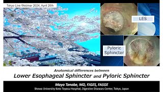 Tokyo Live Webinar Archive Anatomical differences between LES and pyloric sphincter [upl. by Anavlis]