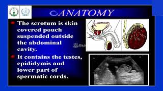 Scrotal Ultrasound  afroasianims [upl. by Kaylyn]