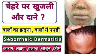 बाल झड़ना और  Seborrheic dermatitis  Hair Falling  Symptoms  causes Treatment  Dr tarun [upl. by Freddy]