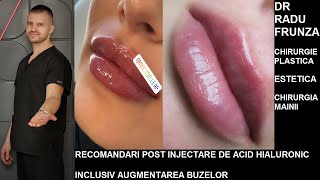 Recomandari post Injectare de Acid Hialuronic inclusiv Augmentarea Buzelor [upl. by Ahsenrac]