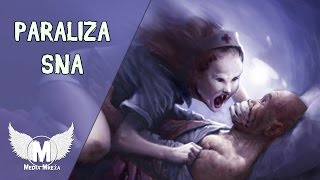 PARALIZA SNA [upl. by Craven]