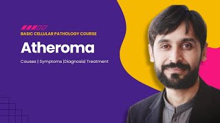 Atheroma  Causes  Symptoms  Diagnosis  Treatment  MLT Hub with kamran [upl. by Ijan218]