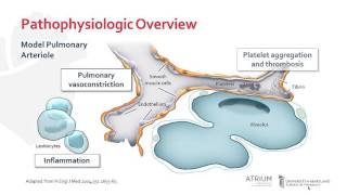 Pathophysiology of Pulmonary Arterial Hypertension [upl. by Wylde533]