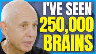 Dr Daniel Amen  STOP These 5 Habits Destroying Your Brain 250000 brain scans [upl. by Malloch]