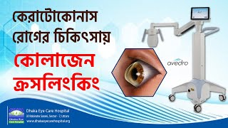 Keratoconus Treatment  Prof Dr Harun Ur Rashid  Dhaka Eye Care Hospital [upl. by Micky12]