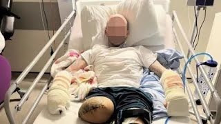 Drugs gang send a brutal message cutting off man’s leg fingers and partners fingers [upl. by Neitsabes717]