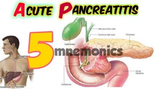 acute pancreatitis causes signs and symptoms pathophysiology investigations treatment [upl. by Resarf916]