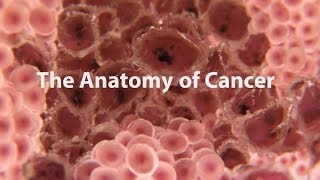 What Is Cancer What Causes Cancer amp How Is It Treated [upl. by Artied]