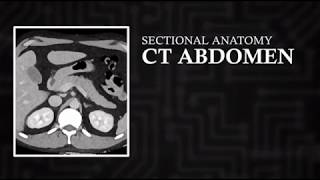 CT Cross Sectional Anatomy Abdomen Axial View [upl. by Cattier]