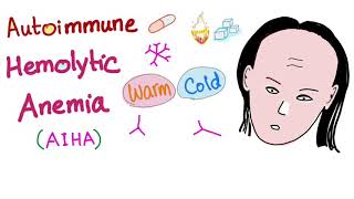 Autoimmune Hemolytic Anemia AIHA  Warm autoantibodies IgG  Hematology [upl. by Remat]