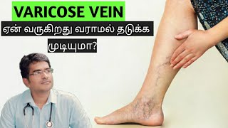 Varicose vein causesamptreatment in tamilmedical awareness in tamil [upl. by Nevuer851]