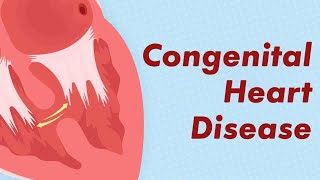 The Many Types of Congenital Heart Disease Explained [upl. by Aldos]