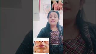 dr motivation Hyperhydrosis Homoeopathic medicine drpoonam Drpunam Sharmapathak [upl. by Algernon64]