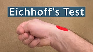 Eichhoff’s Test for De Quervain’s Tenosynovitis  The Finkelstein’s Test that you do Yourself [upl. by Seaden792]