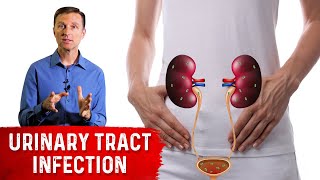 Top Remedies for a UTI Urinary Tract Infection Updated [upl. by Ahsema]